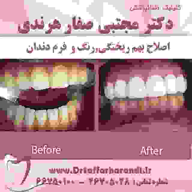 دندانپزشک خوب در غرب تهران نی نی سایت