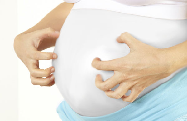خارش پوست در دوران بارداری