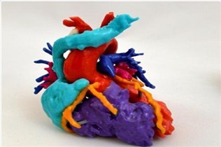 ساخت قلب چاپ سه‌بعدی برای کاهش جراحی‌های قلب کودکان