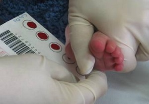 راه‌اندازی آزمایشگاه متابولیک برای غربالگری نوزادان