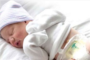 فتق ناف نوزاد خطرناک است؟