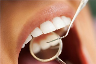 آیا برای تغییر رنگ دندان به دندانپزشک مراجعه شود؟
