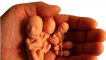 با 6 نوع سقط و علت‌های آن آشنا شوید