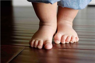بدشکلی پای کودک ناشی از پوشک کردن قابل درمان است؟