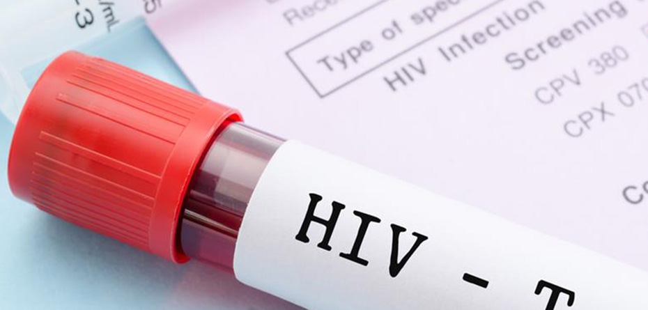 36 هزار مبتلا به ایدز شناسایی شده اند