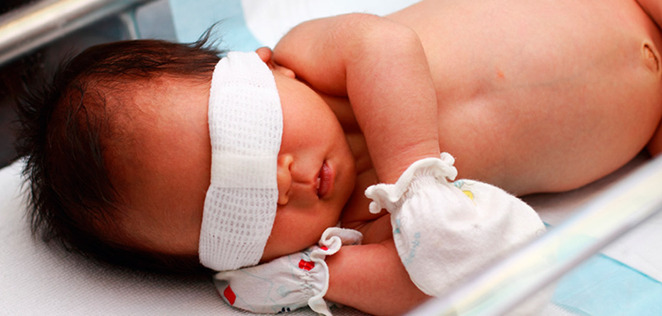 درمان زردی نوزاد چیست؟