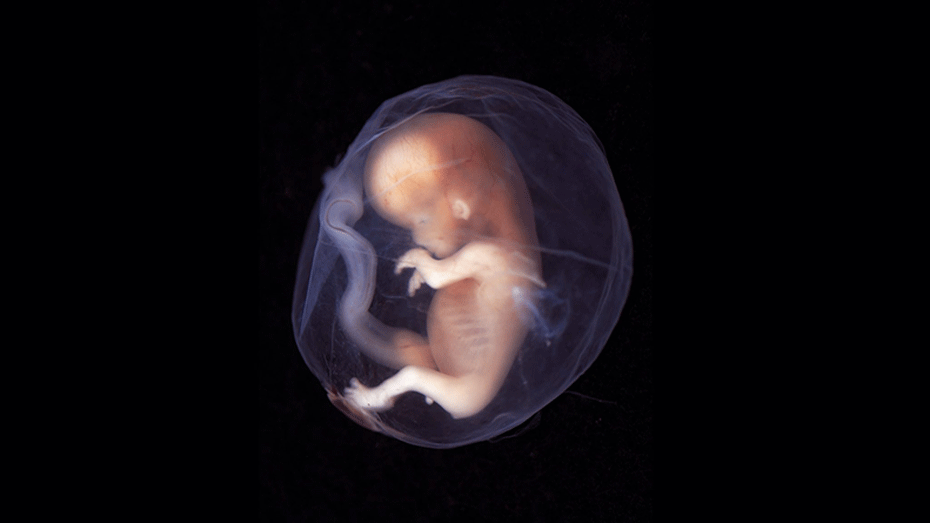 نگران بارداری بعد از سقط جنین نباشید