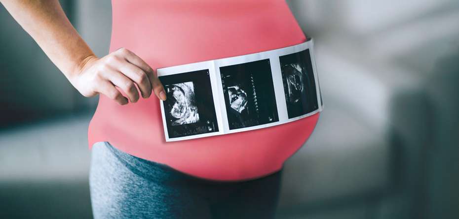  آزمایش ها و سونوگرافی های دوران بارداری
