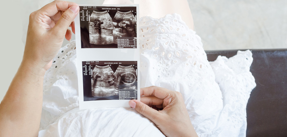  اندازه گیری وزن جنین در سونوگرافی دقیق است؟