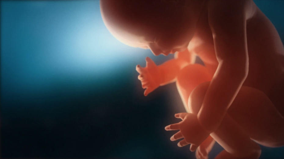 تالاسمی ماژور در فهرست سقط قانونی