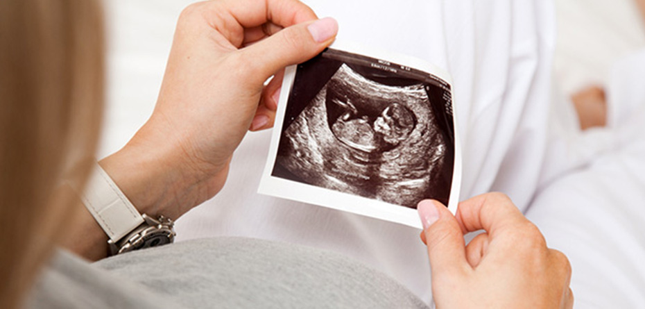 لب شکری شدن جنین در چه ماهی از بارداری رخ می دهد؟
