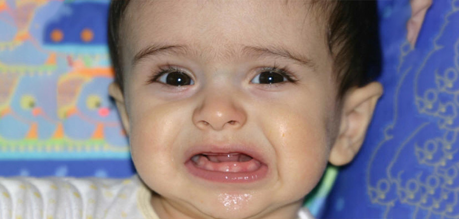 تجویز بی رویه آنتی بیوتیک‌ در سنین رشد دندان کودکان
